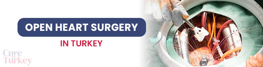 Open Heart Surgery